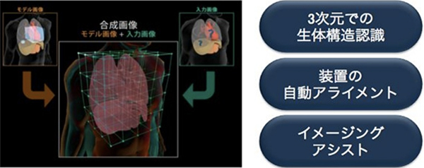 MRI（東芝メディカルシステムズ社）